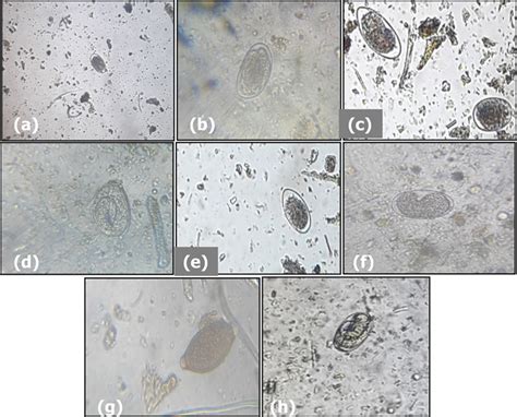  Eimeria! Wie Einzigartig Sind Diese Mikro-Parasiten In Der Tierwelt?